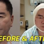 CP-2023-0235-34162986-thumb